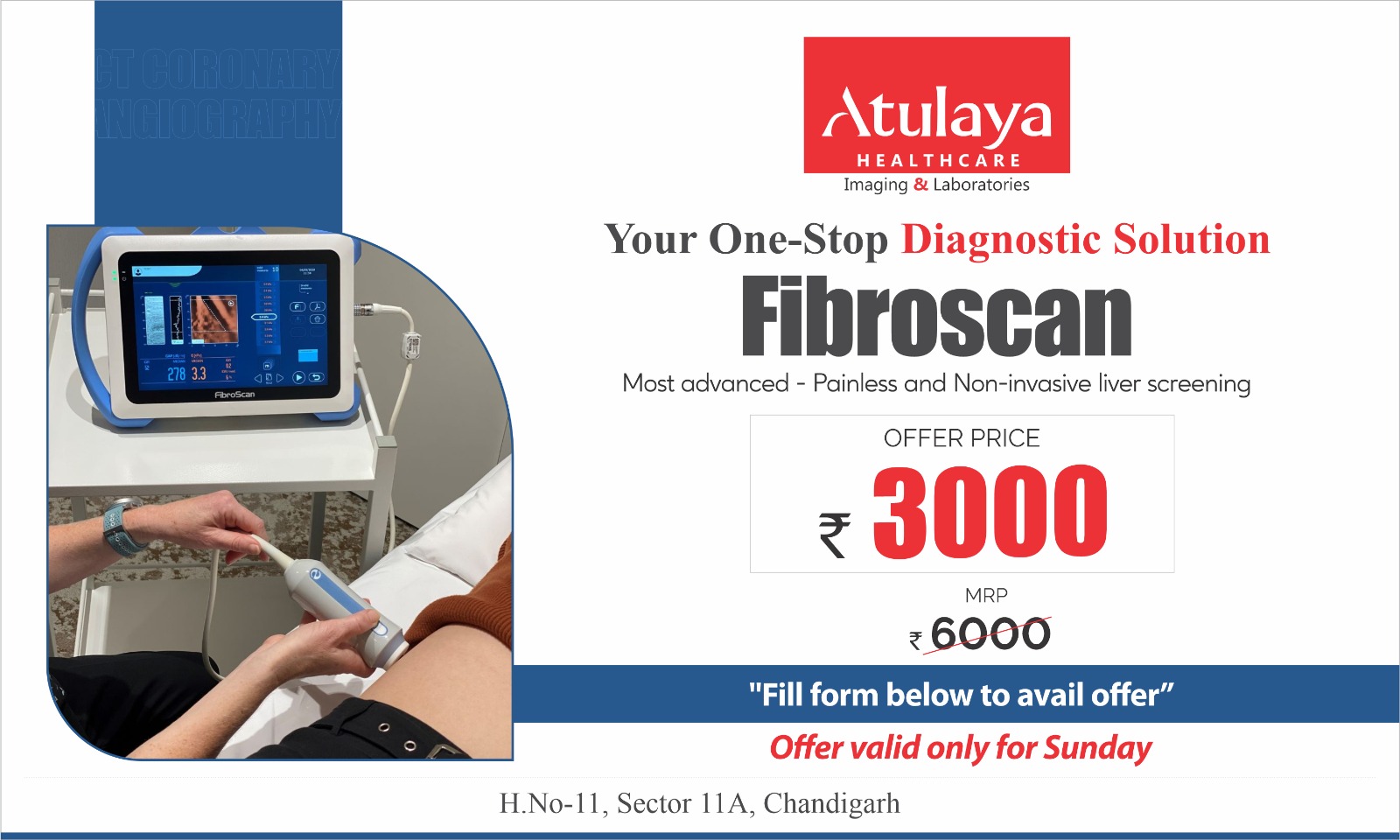 FibroScan